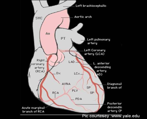 coronary-artery1