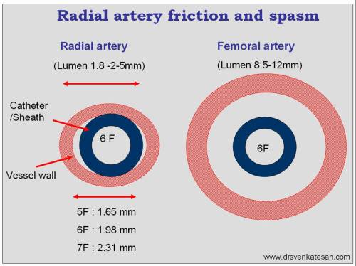 radial-artery-spasm