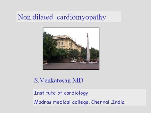 non dilated  cardiomyopathy