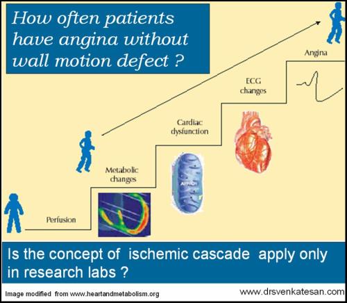 ischemic  cascade angina ecg wall motion defect nstemi