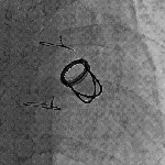 STARR EDWARDS VALVE 2