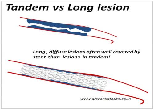 tandem verses long lesions