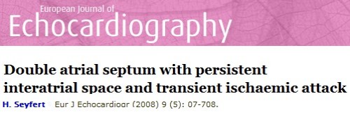 double atrial septum ias inter atrail septum pfo variant ptmc difficult septal puncture