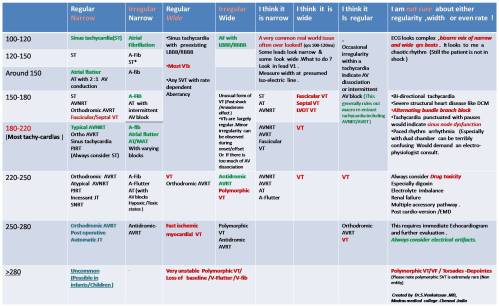 approach to cardiac arrhythmias narrow qrs vs wide qrs brugada wellens criteria