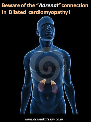 pheochromocytoma and dilated cardiomyopathy reversible dcm tachycardic