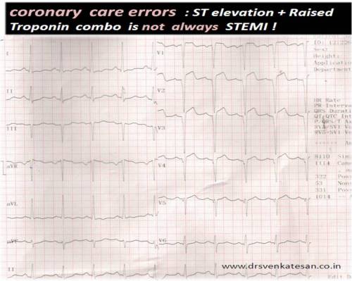 Q-LVH INCOMPLET LBBB STEMI DIFFERENTIAL DIAGNOSIS 2