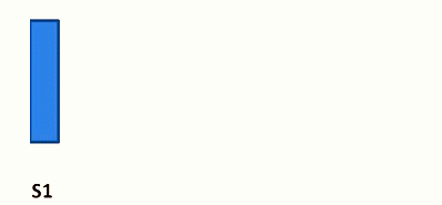 mid diastolic murmur 