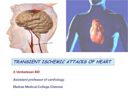 transient ischemic attacks attack of heart coronary tia