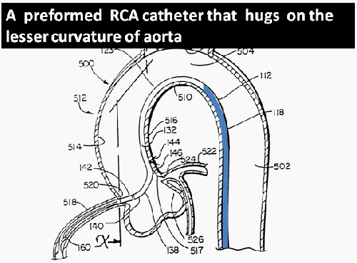 preformed rca catheter