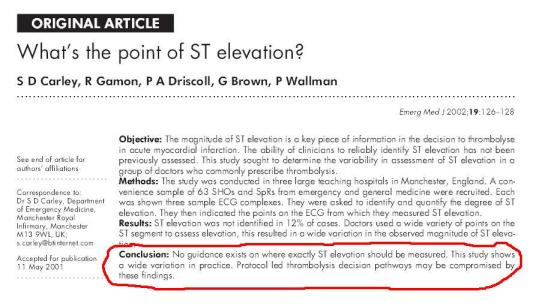 How to measure ST elevation in ECG