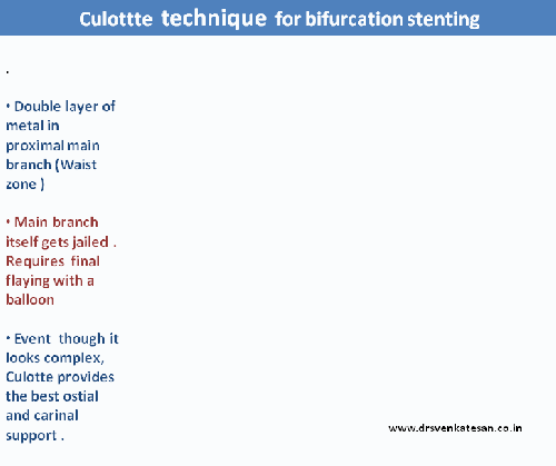 culotte technique  stenting ptca pci 002