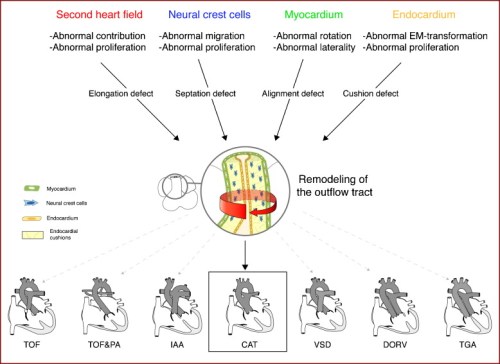 cono truncal anomalies embryology of heart