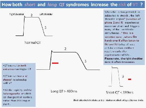 qt interval animation short and long002