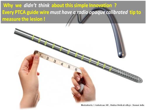 calibrated ptca guidewire