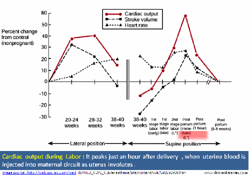 cardiac output  during labor and postpartum 002