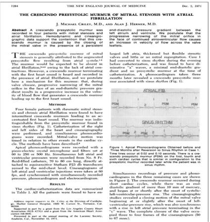 Criely mitral stenosis pressytolic accentuation ausultation atrial fibrillation