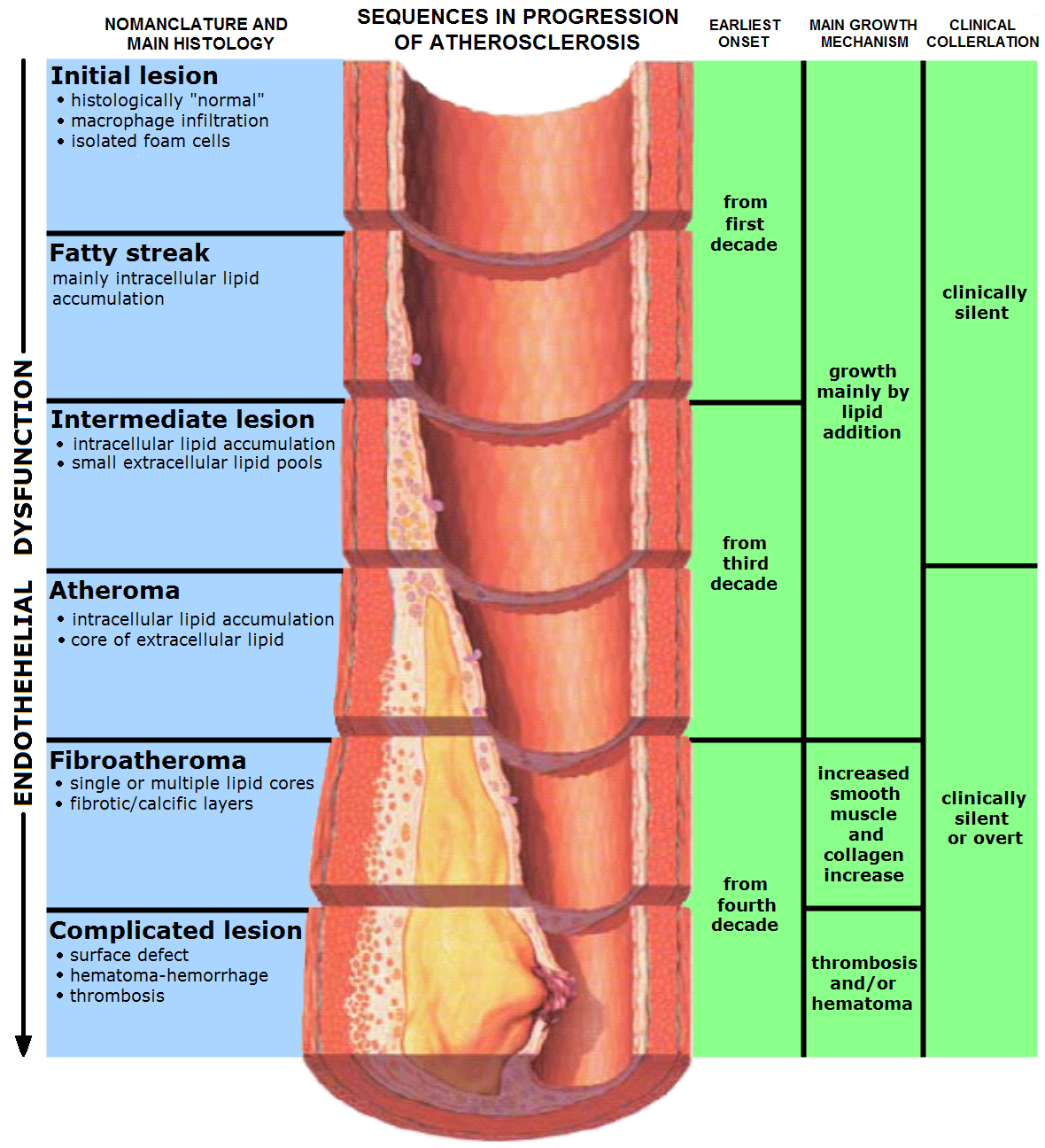 atherosclerosis flow limiting lesion glagov plaque rupture vulnerable erosion fissure vs dissection