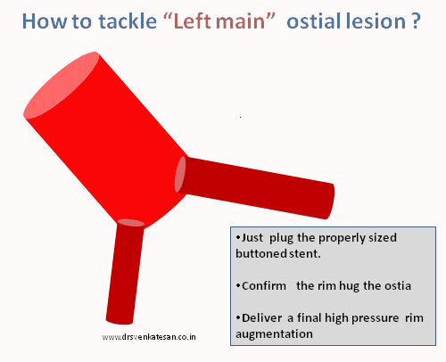 Left main  ostial  stenting lesion002