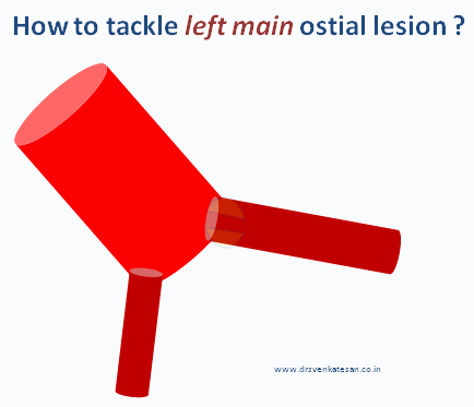Left main  ostial  stenting lesion003