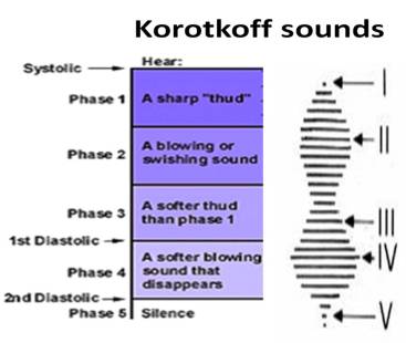 korrotkoff sounds