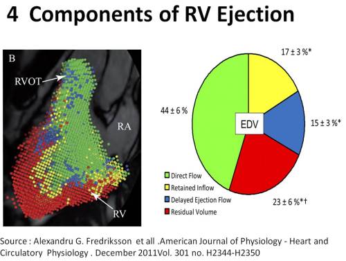 right ventricle physiology anatomy hemodynamics