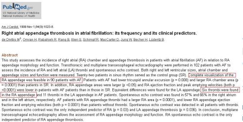 right atrial appendage clot raa clot in af atrial fibrillation