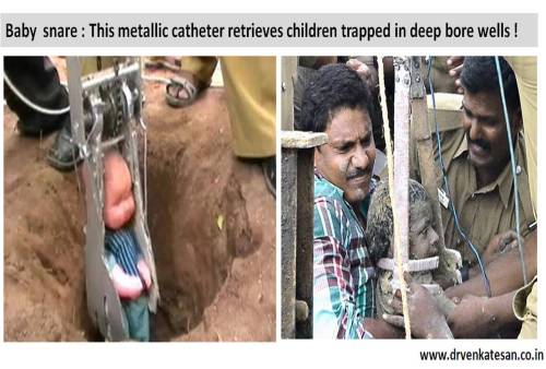 baby snare bore well cath lab snares asd vsd device av loop how to snare a device