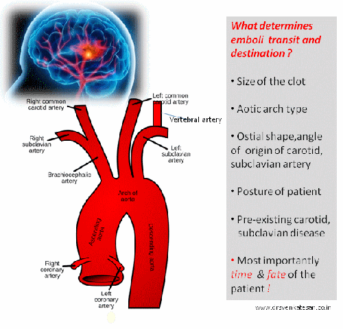Atrial fibrillation | Dr.S.Venkatesan MD