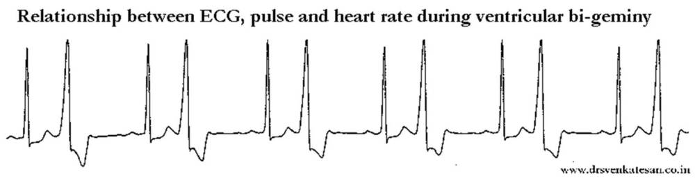 Auscultation | Dr.S.Venkatesan MD
