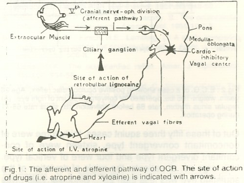 oculo cardiac reflex