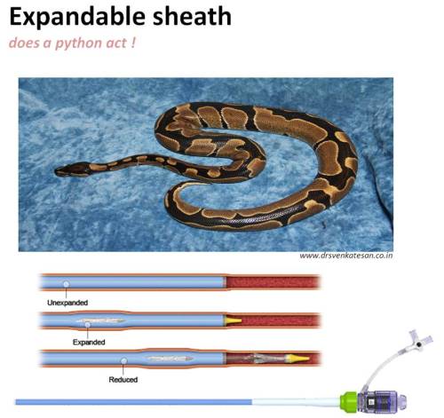 Expandable sheath 164 solo path tavi tavr cathlab hardware
