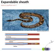 Expandable sheath 164 solo path tavi tavr cathlab hardware