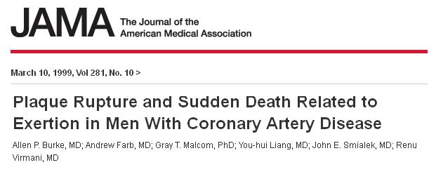 plaque fissure and exertion physical and mental exertion and plaque