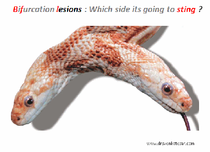 bifurcation lesions medina stenting srategies 002