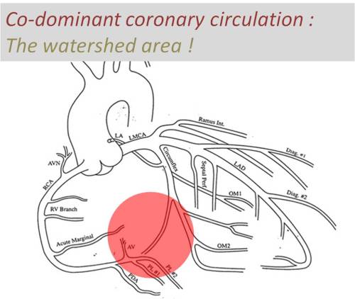 coronary codomiant circulation