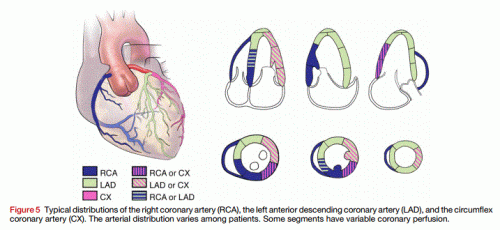stemi localisation by echo inferior rca lcx
