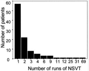 nsvt incidence hocm
