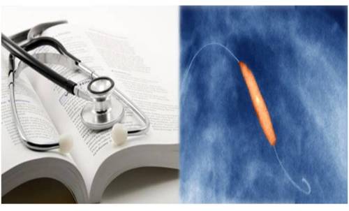 ptca ira non ira multivesssel pci