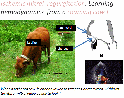 ischemic mitral regurgitation functional carpentier drsvenkatesan venkatesan madras medcial college 002