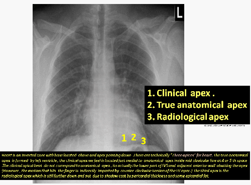 lv apex radiological clinical anatomical