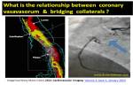 coronary vasavasorum bridging collaterals&nbsp;2