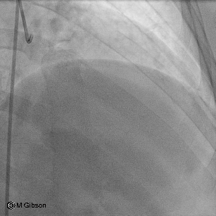 Who nourishes  maintians the intergity of these trippel layerd live tube 