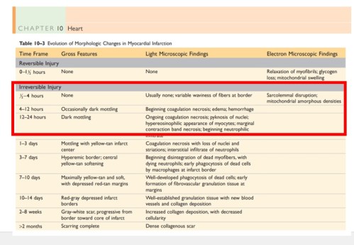 Time window in stemi 6 hour 12 hour or 90 minutes