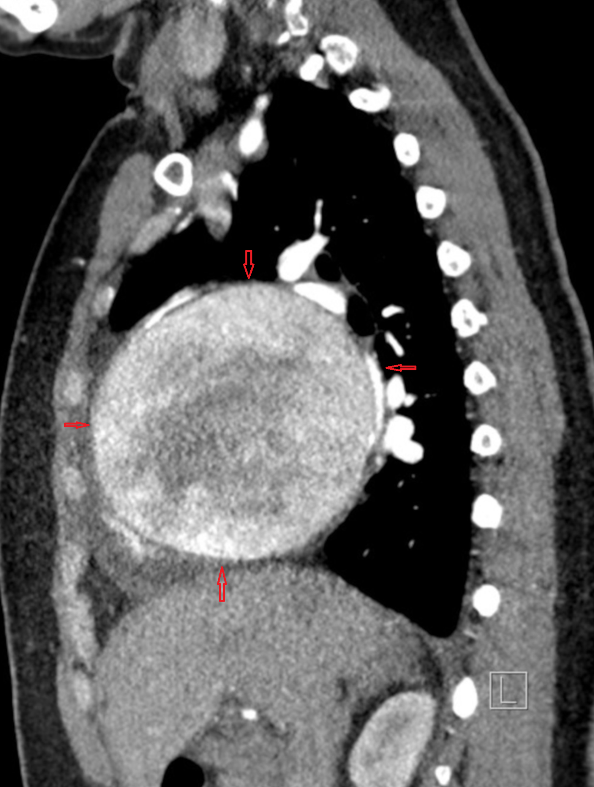 Most curious Image in cardiology