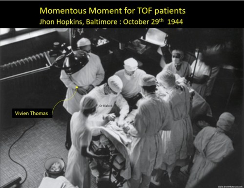 Vivien thomas blalock tausig BTT shunt baltimore jhon hopkins gross. 2 jpg