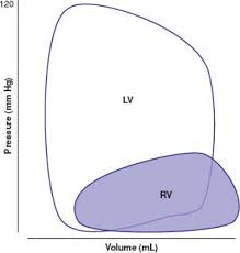 rv pressure volume loop | Dr.S.Venkatesan MD